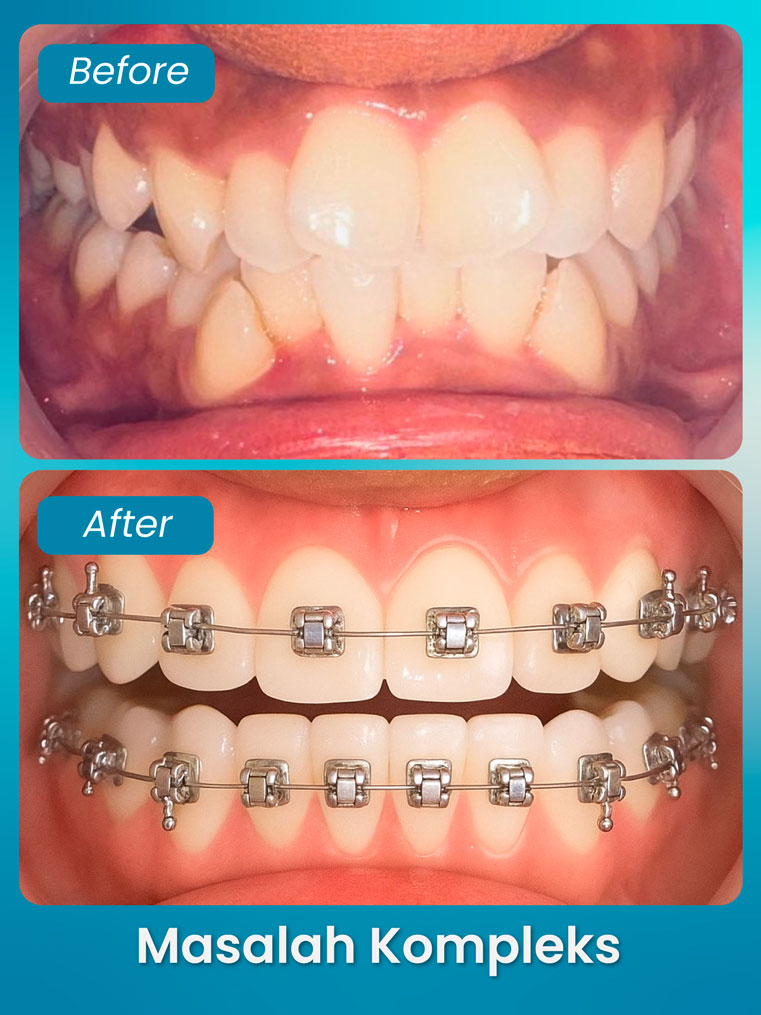 masalah kompleks 1 - klinik pergigian bluvia dental