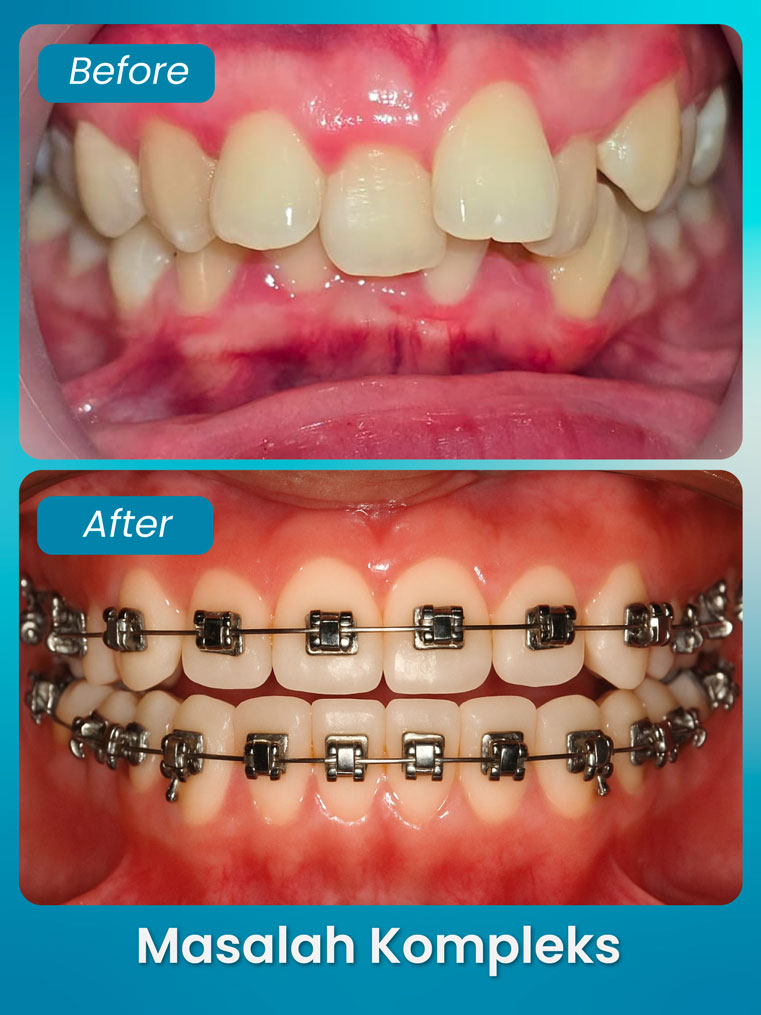 masalah kompleks 3 - klinik pergigian bluvia dental